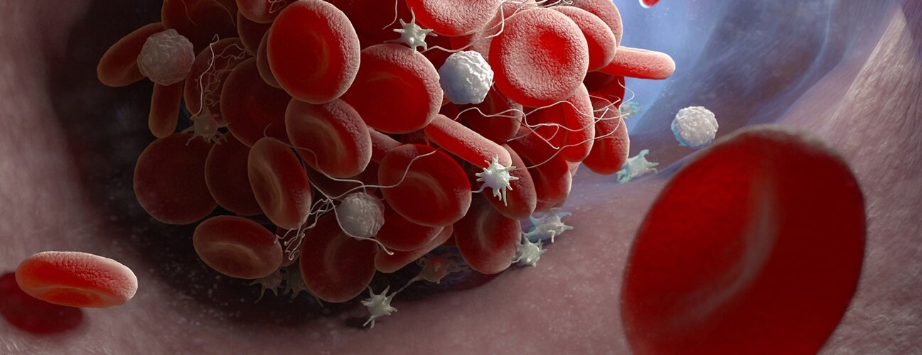 All About Breast Cancer Tissue